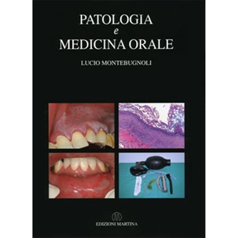 PATOLOGIA e MEDICINA ORALE